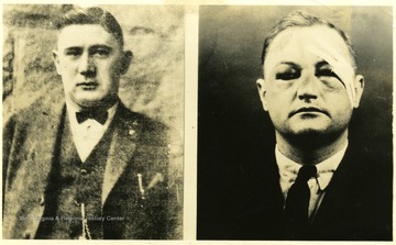 Portraits of Don Chafin, "The Czar" left, and Mastin White, a victim with injuries on his face, right. 