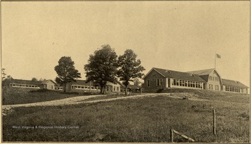 View of the State Tuberculosis Sanitarium. E. E. Clovis, M. D., Superintendent. This institution is located two miles east of Terra Alta, Preston county, on the main line of the Baltimore and Ohio Railroad. The local station is called Hopemont, but only local trains stop here. All passenger trains stop at Terra Alta, which is the express and post office. Number of patients treated during June, 1914 was 65.
